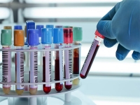 Servicios de Laboratorio Clínico.
